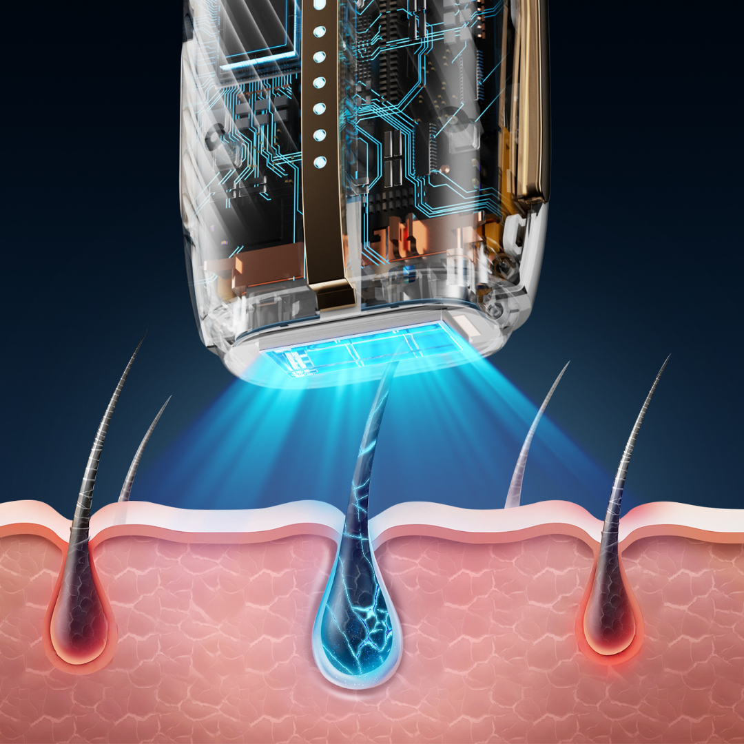 Achieve Salon-Quality Hair Removal at Home.